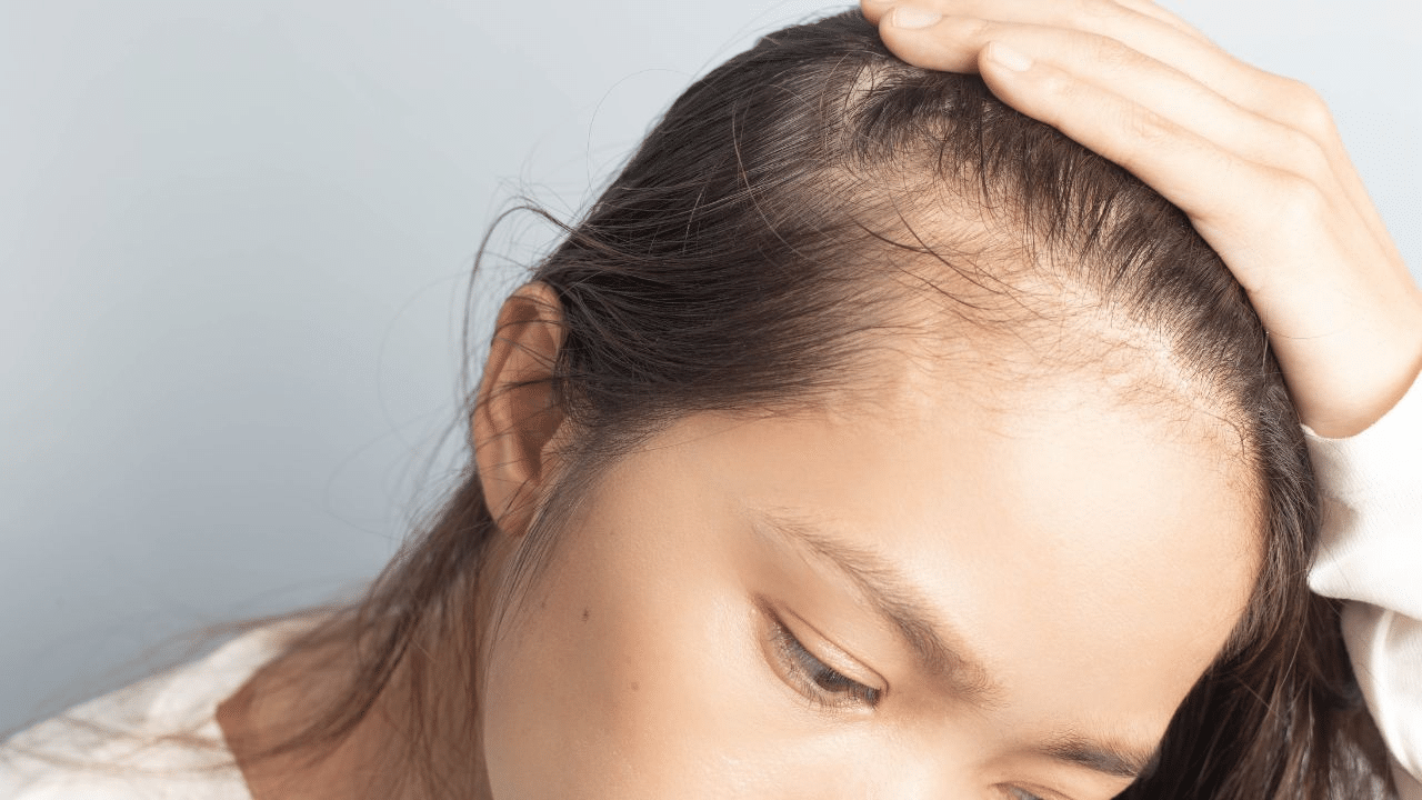 Secretos de los tés que ayudan con la calvicie